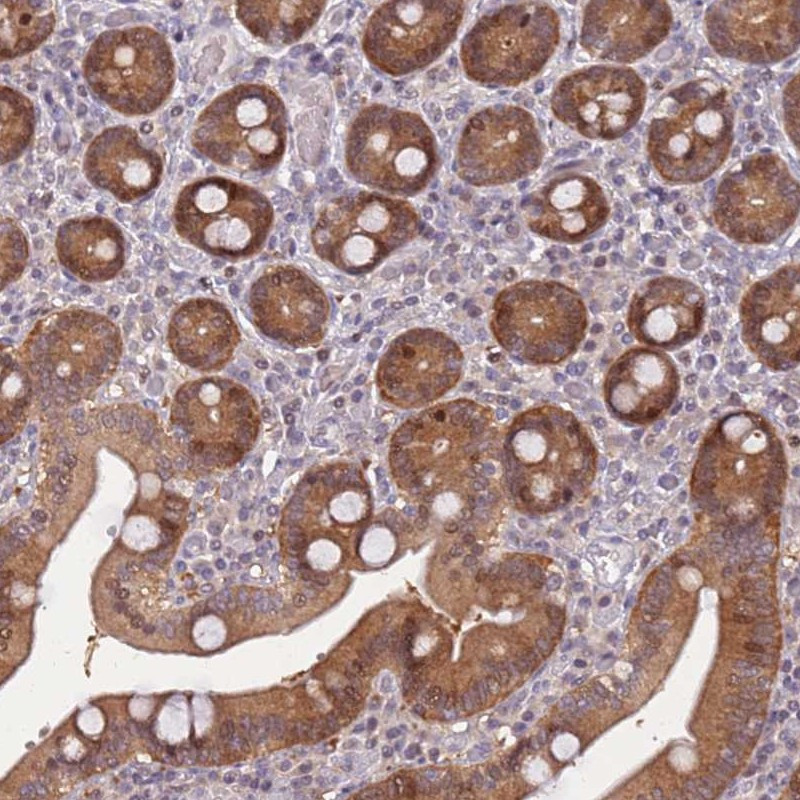 Immunohistochemical staining of human duodenum shows moderate positivity in glandular cells.