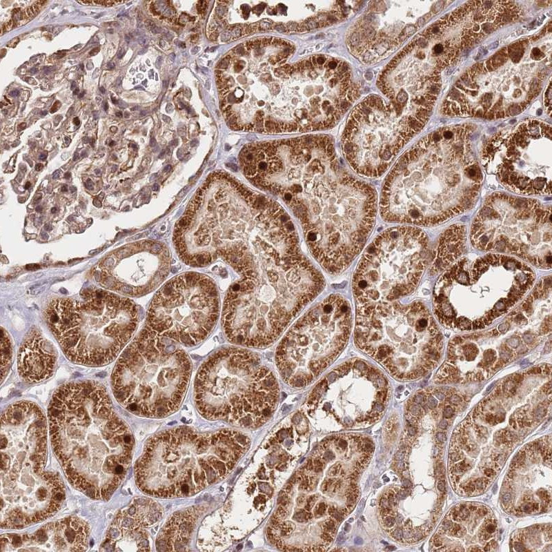 Immunohistochemical staining of human kidney shows strong cytoplasmic and nuclear positivity in renal tubules.