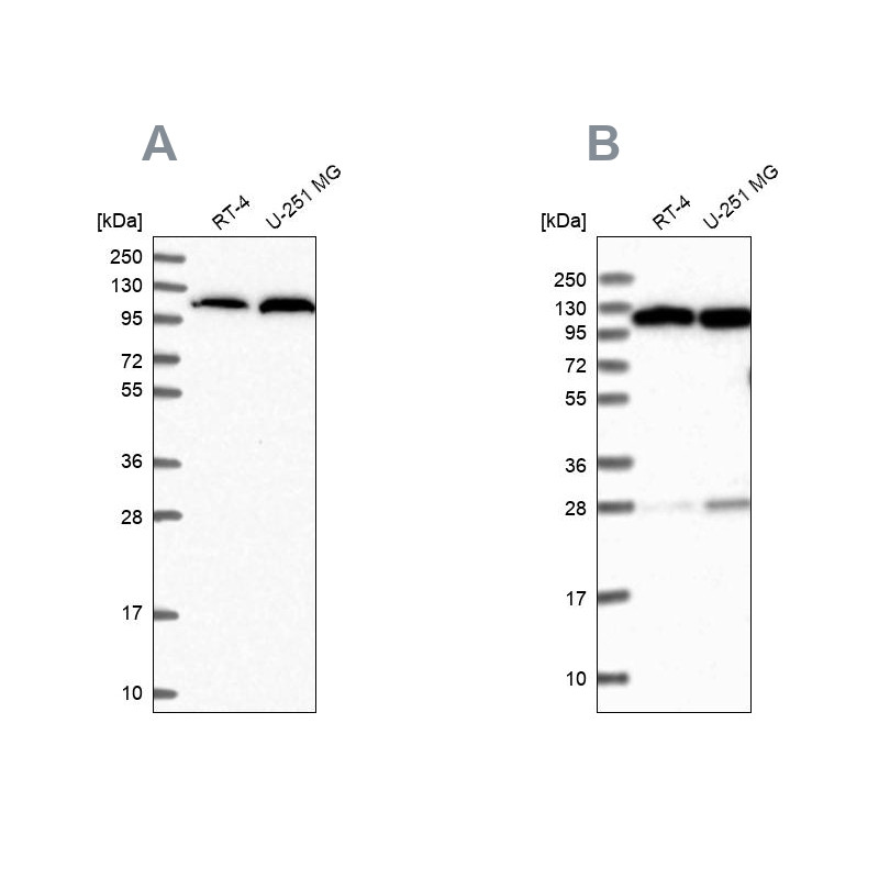 Western blot analysis using Anti-AARS antibody HPA044223 (A) shows similar pattern to independent antibody HPA040870 (B).