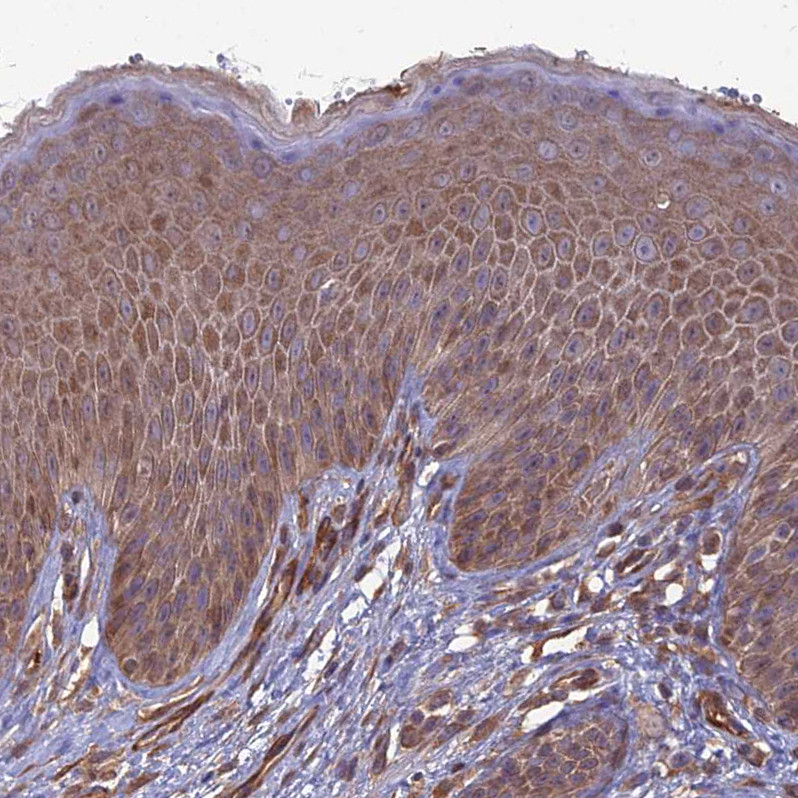 Immunohistochemical staining of human skin shows moderate cytoplasmic positivity in squamous epithelial cells.
