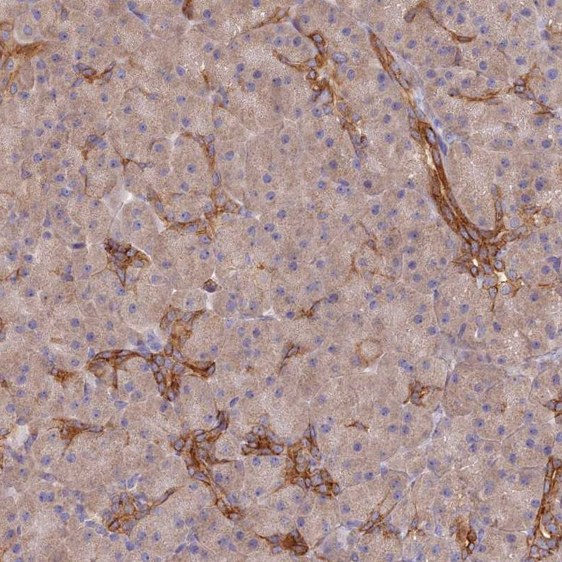 Immunohistochemical staining of human pancreas shows distinct cytoplasmic positivity in ducts.