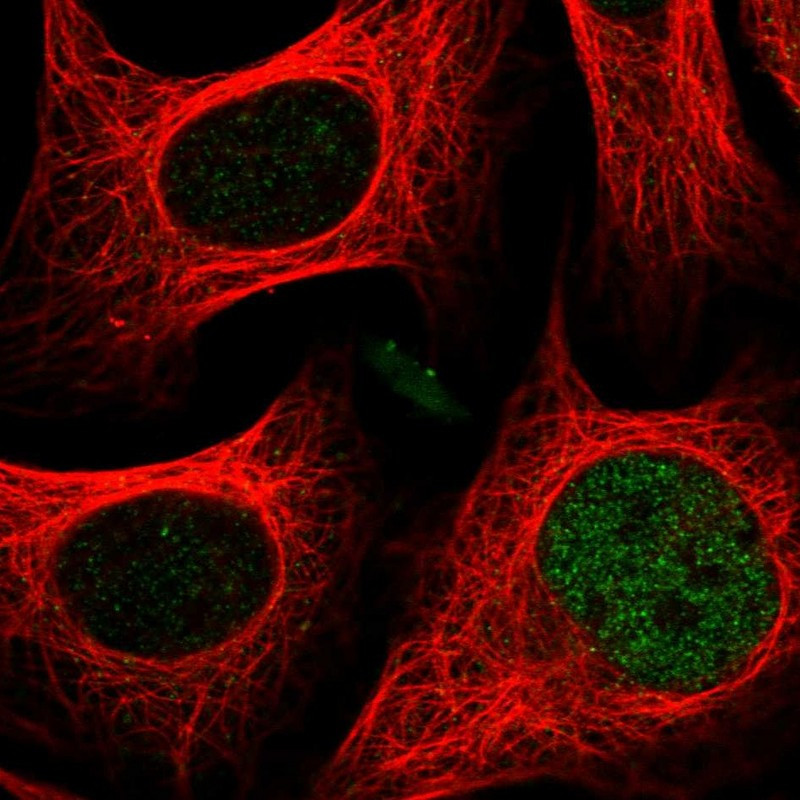 Immunofluorescent staining of human cell line U-2 OS shows localization to nucleoplasm.