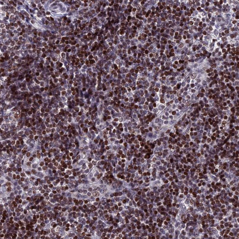 Immunohistochemical staining of human tonsil shows strong nuclear positivity in non-germinal center cells.