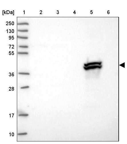 Lane 1: Marker [kDa] 250, 130, 95, 72, 55, 36, 28, 17, 10<br/>Lane 2: Human cell line RT-4<br/>Lane 3: Human cell line U-251MG sp<br/>Lane 4: Human plasma (IgG/HSA depleted)<br/>Lane 5: Human liver tissue<br/>Lane 6: Human tonsil tissue