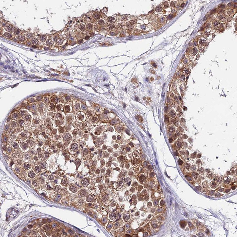 Immunohistochemical staining of human testis shows moderate cytoplasmic positivity in cells in seminiferous ducts.