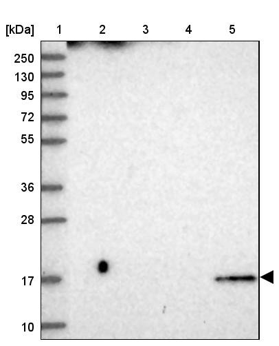 Lane 1: Marker [kDa] 250, 130, 95, 72, 55, 36, 28, 17, 10<br/>Lane 2: Human cell line RT-4<br/>Lane 3: Human cell line U-251MG sp<br/>Lane 4: Human plasma (IgG/HSA depleted)<br/>Lane 5: Human liver tissue
