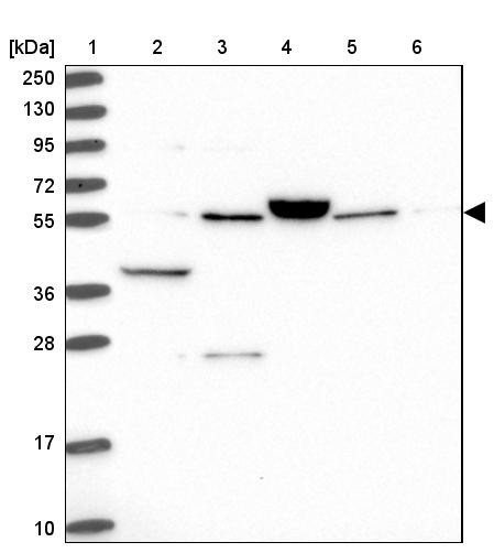 Lane 1: Marker [kDa] 250, 130, 95, 72, 55, 36, 28, 17, 10<br/>Lane 2: Human cell line RT-4<br/>Lane 3: Human cell line U-251MG sp<br/>Lane 4: Human plasma (IgG/HSA depleted)<br/>Lane 5: Human liver tissue<br/>Lane 6: Human tonsil tissue