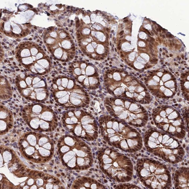 Immunohistochemical staining of human colon shows strong nuclear and cytoplasmic positivity in glandular cells.