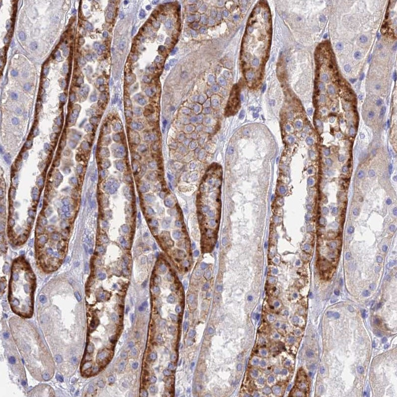 Immunohistochemical staining of human kidney shows strong cytoplasmic positivity in renal tubules.