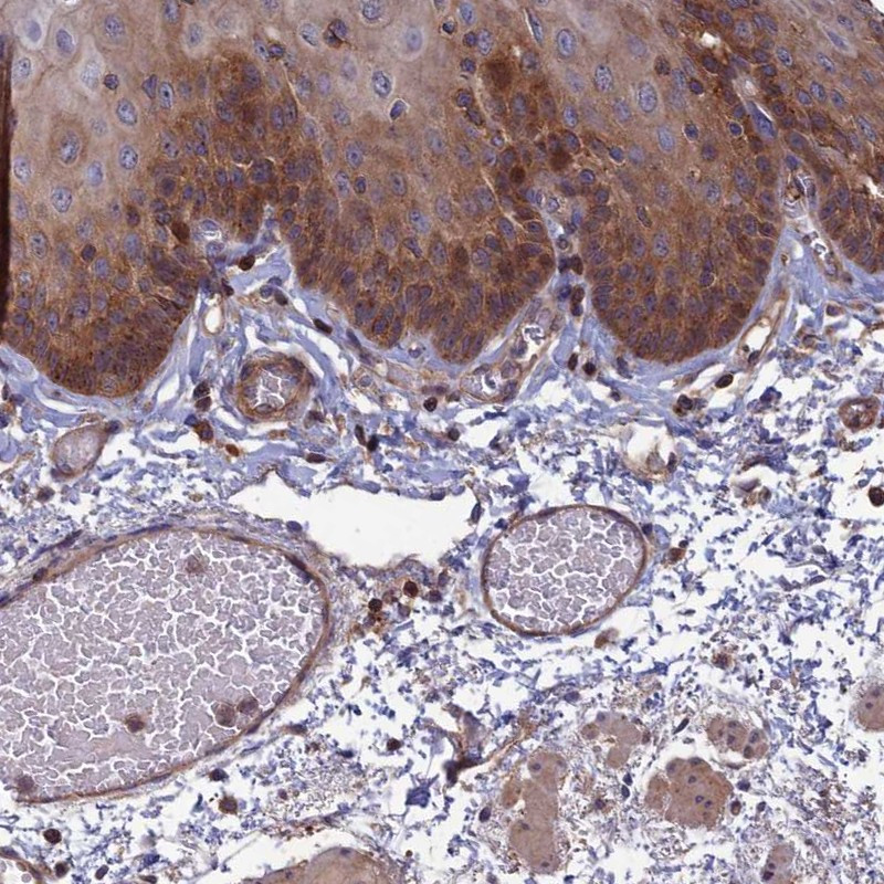 Immunohistochemical staining of human esophagus shows moderate cytoplasmic positivity in squamous epithelial cells.