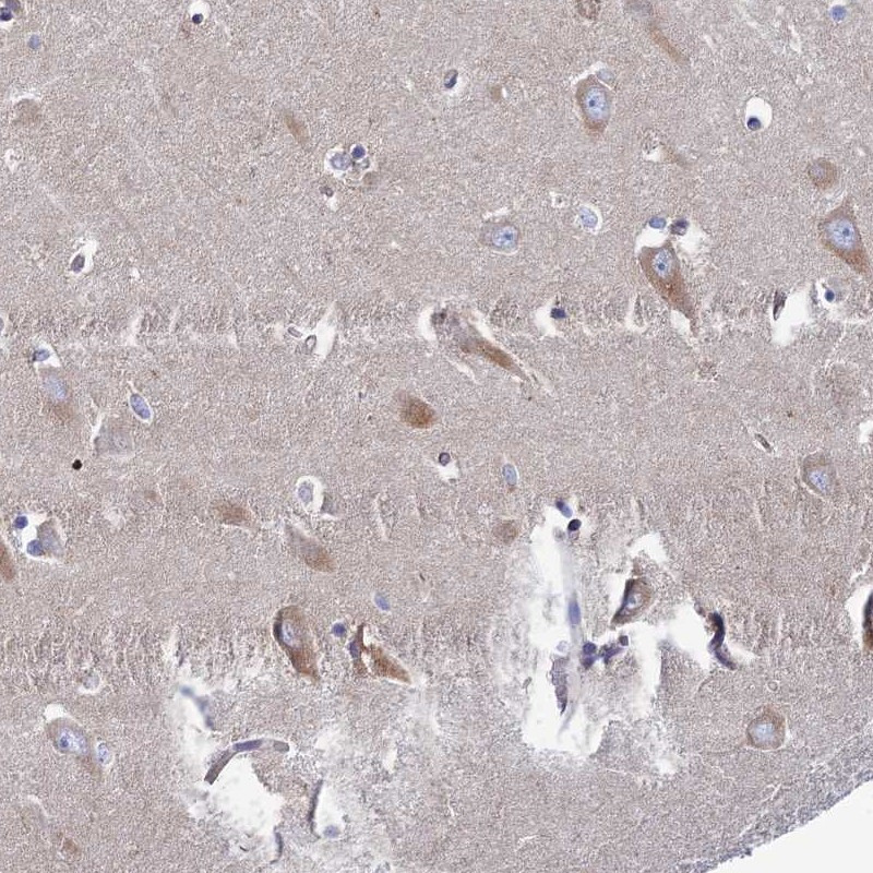 Immunohistochemical staining of human hippocampus shows moderate cytoplasmic positivity in neuronal cells.