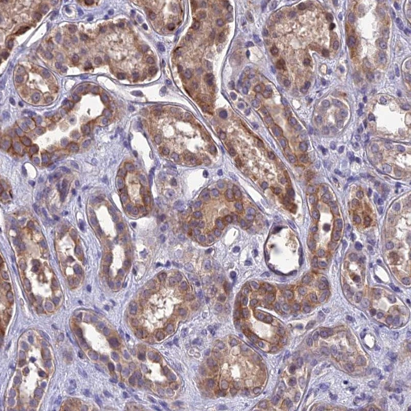 Immunohistochemical staining of human kidney shows moderate cytoplasmic and membranous positivity in cells in tubules.