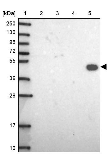 Lane 1: Marker [kDa] 250, 130, 95, 72, 55, 36, 28, 17, 10<br/>Lane 2: Human cell line RT-4<br/>Lane 3: Human cell line U-251MG sp<br/>Lane 4: Human plasma (IgG/HSA depleted)<br/>Lane 5: Human liver tissue