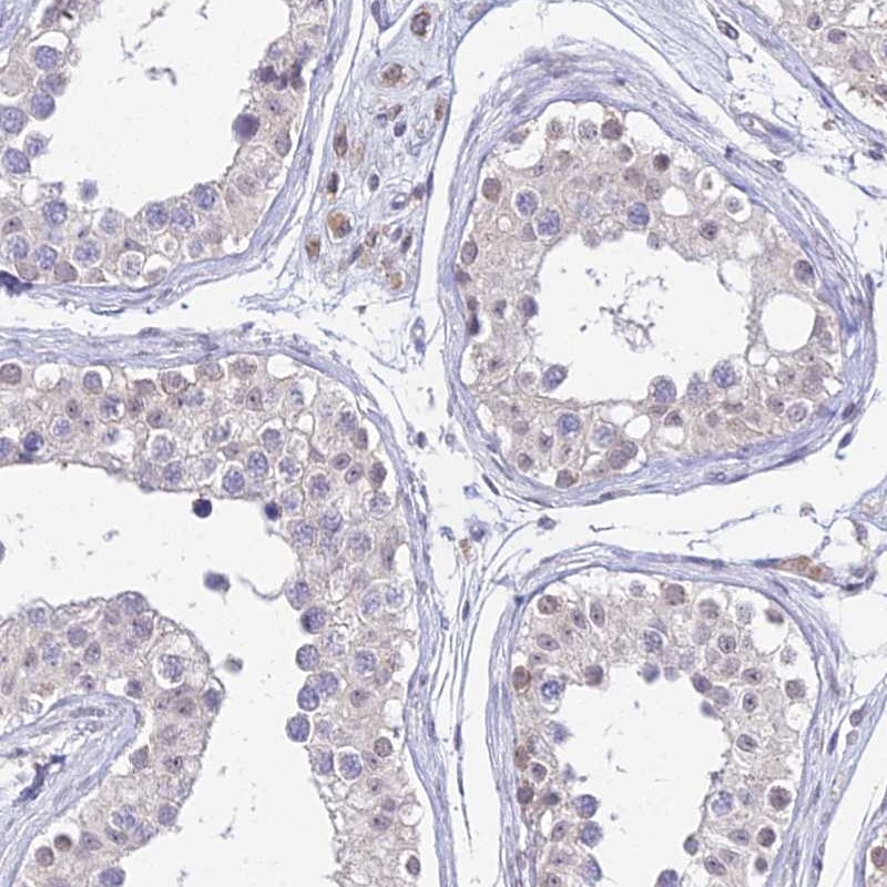 Immunohistochemical staining of human testis shows cytoplasmic positivity in seminiferus ducts.