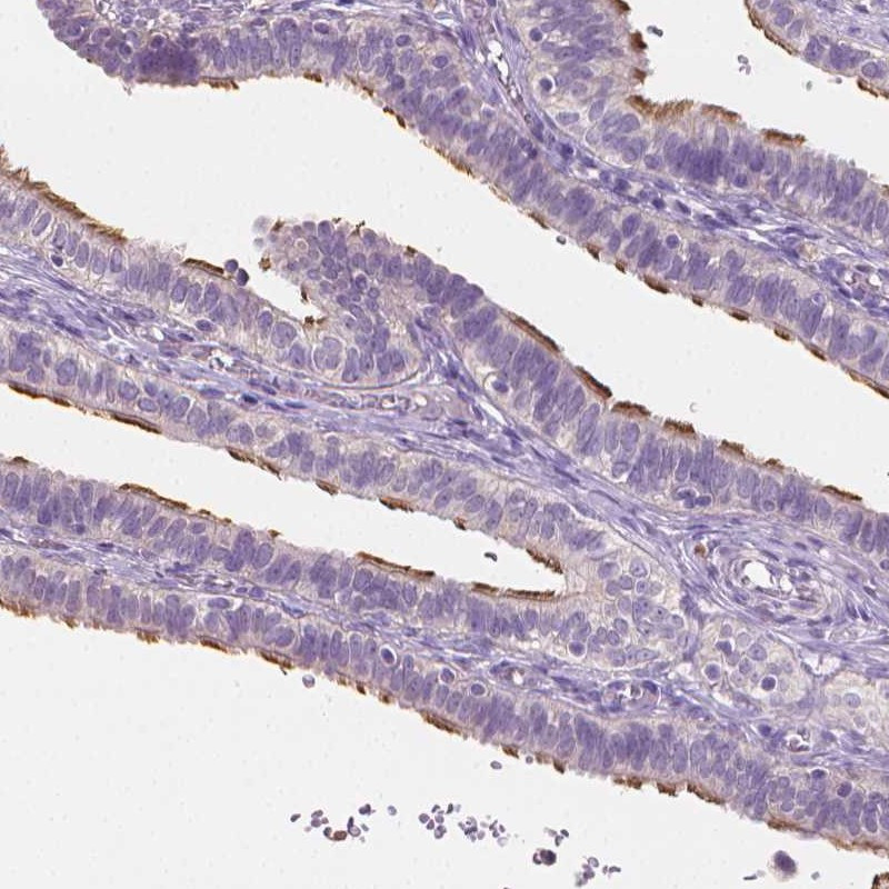 Immunohistochemical staining of human fallopian tube shows cilia positivity in glandular cells.