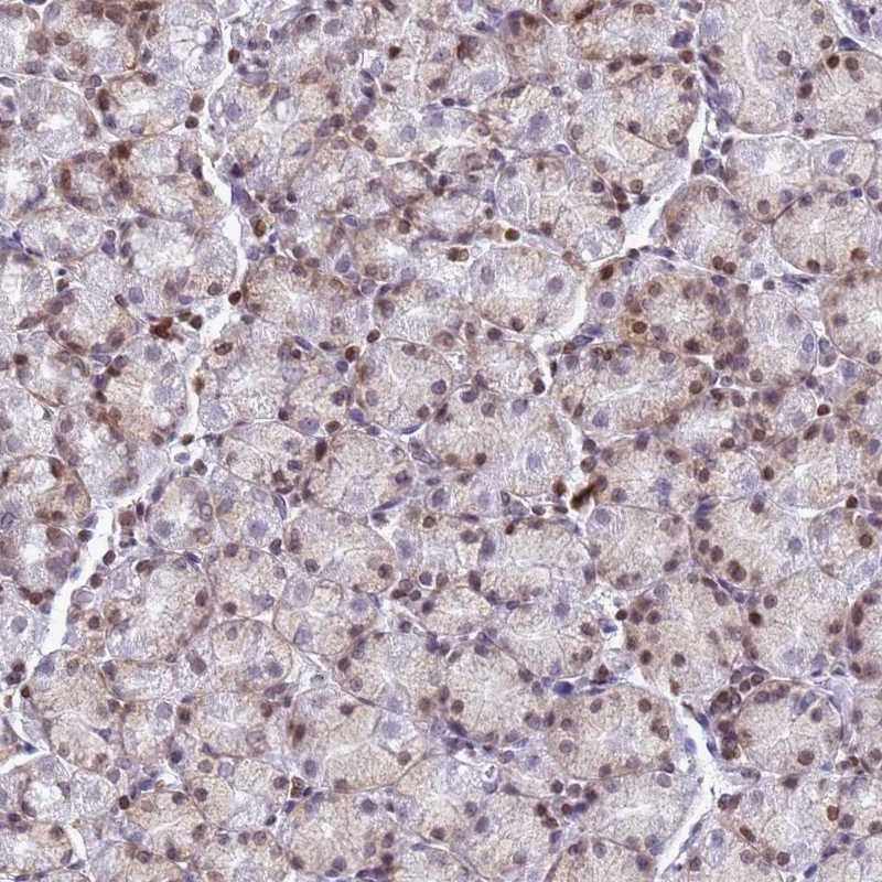Immunohistochemical staining of human stomach (lower) shows moderate cytoplasmic and nuclear positivity in glandular cells.