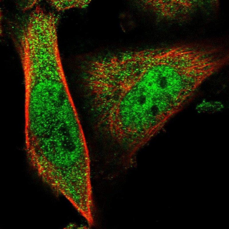 Immunofluorescent staining of human cell line U-251 MG shows localization to nucleoplasm & cytosol.