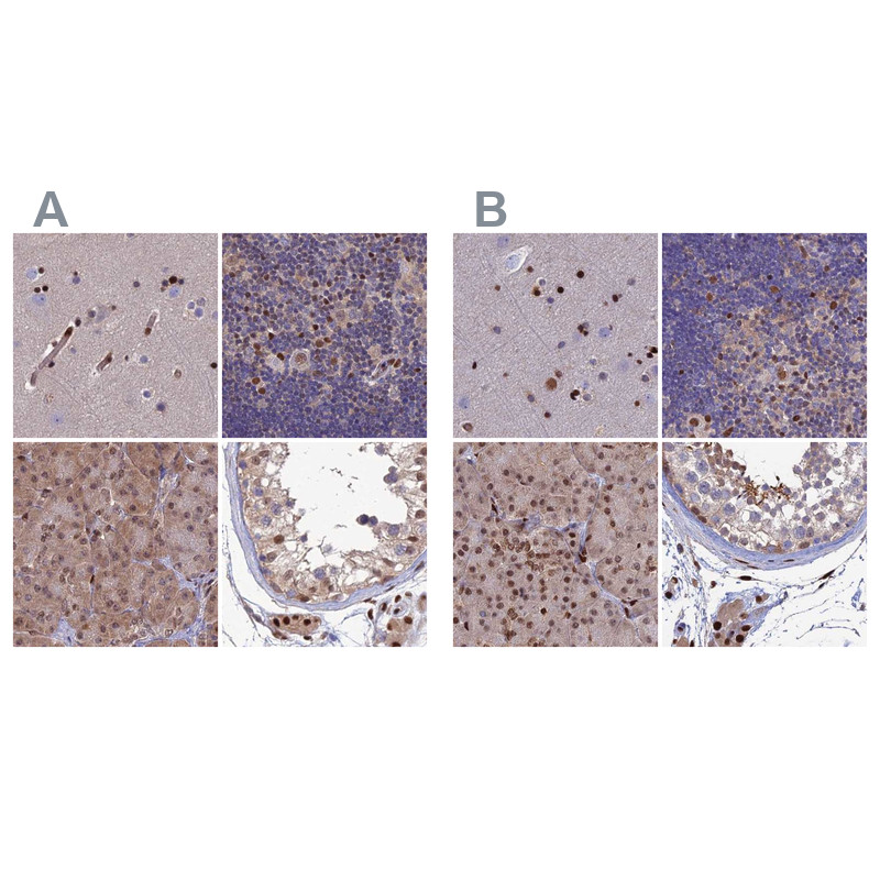 Immunohistochemical staining of human cerebral cortex, lymph node, pancreas and testis using Anti-DNPEP antibody HPA044860 (A) shows similar protein distribution across tissues to independent antibody HPA036398 (B).