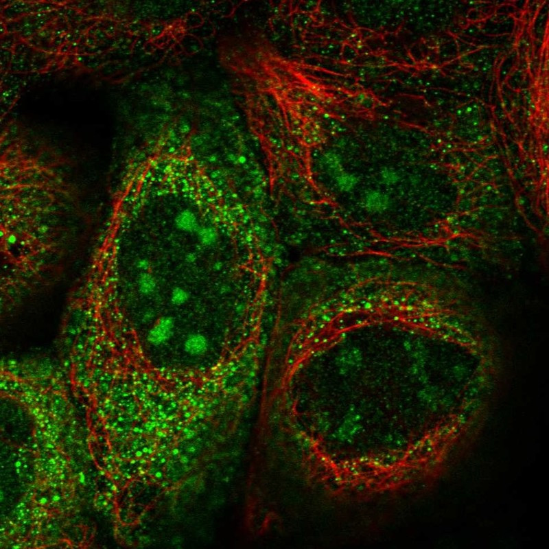 Immunofluorescent staining of human cell line A-431 shows localization to nucleoli & cytosol.