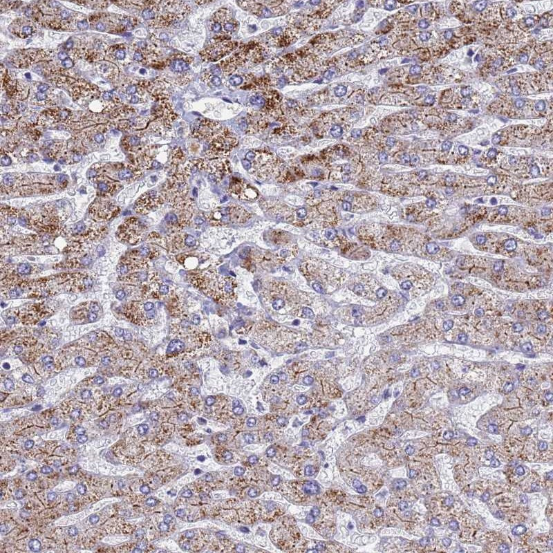 Immunohistochemical staining of human liver shows moderate granular positivity in hepatocytes.