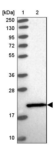 Lane 1: Marker [kDa] 250, 130, 95, 72, 55, 36, 28, 17, 10<br/>Lane 2: Human cell line RT-4