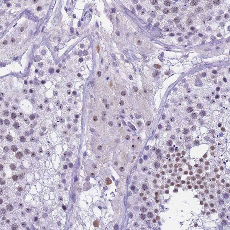 Immunohistochemical staining of human testis shows moderate nucleolar positivity in cells in seminiferus ducts and Leydig cells.