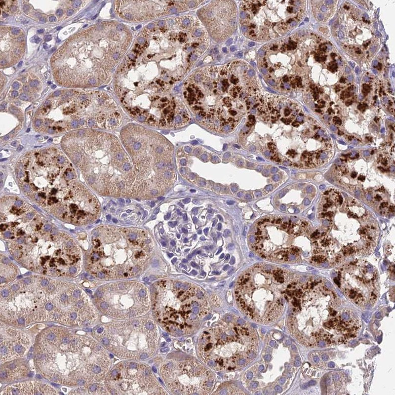 Immunohistochemical staining of human kidney shows strong granular cytoplasmic positivity in cells in tubules.