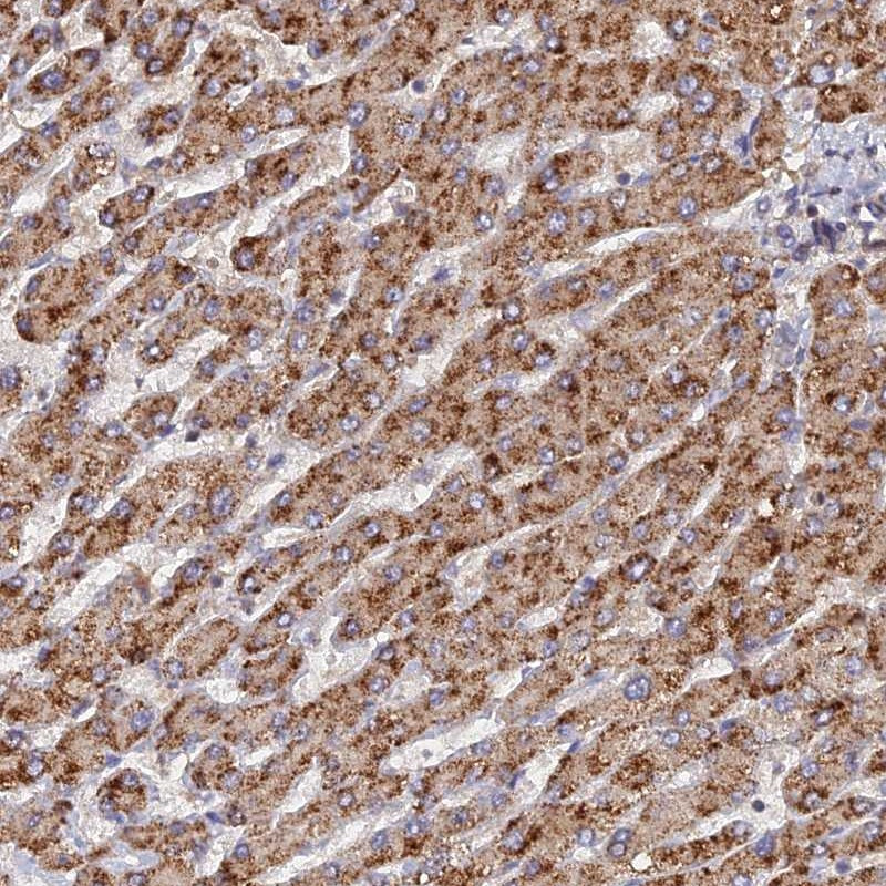 Immunohistochemical staining of human liver shows strong cytoplasmic positivity in hepatocytes.