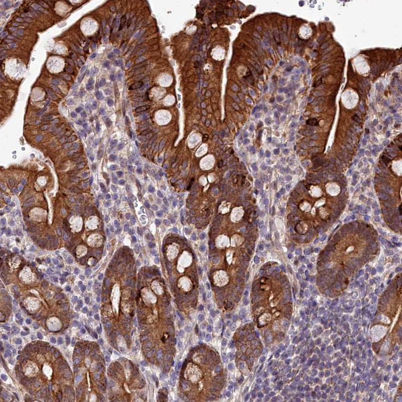Immunohistochemical staining of human duodenum shows strong cytoplasmic and membranous positivity in glandular cells.