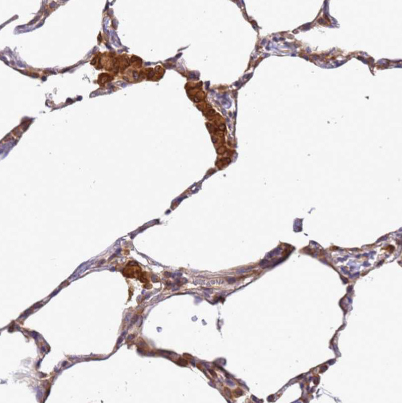 Immunohistochemical staining of human lung shows strong cytoplasmic positivity in macrophages.