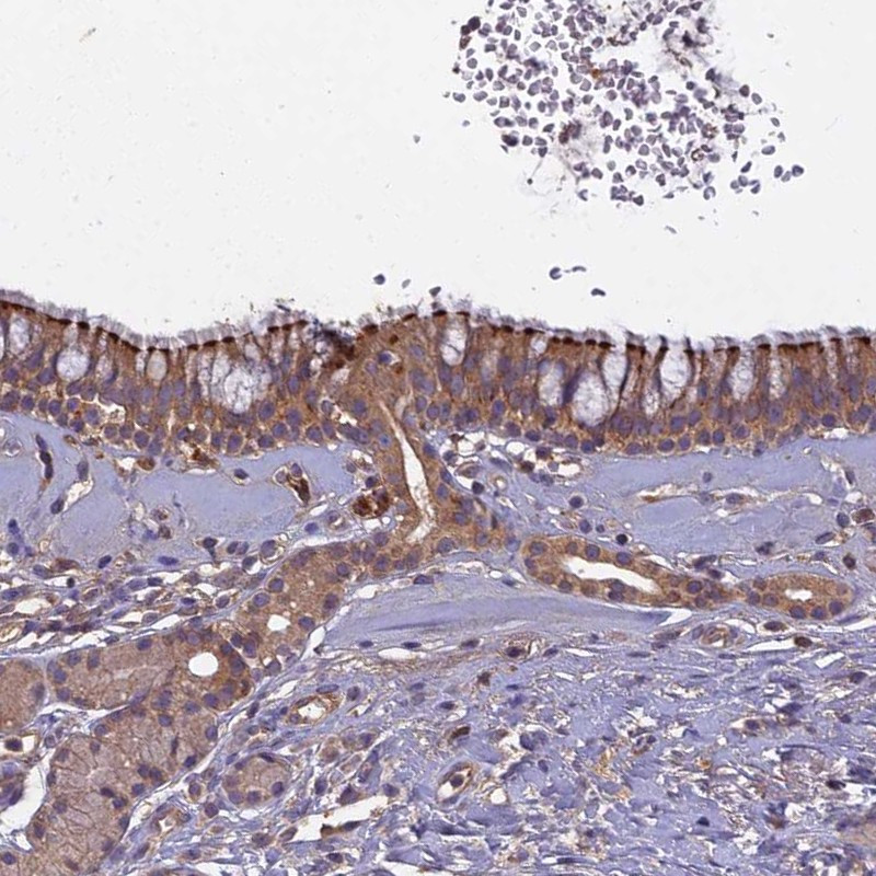 Immunohistochemical staining of human nasopharynx shows strong membranous positivity in respiratory epithelial cells.