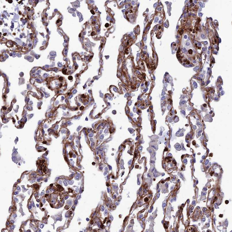 Immunohistochemical staining of human lung shows moderate to strong membranous positivity in pneumocytes.