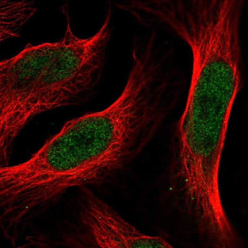 Immunofluorescent staining of human cell line U-2 OS shows localization to nucleoplasm.