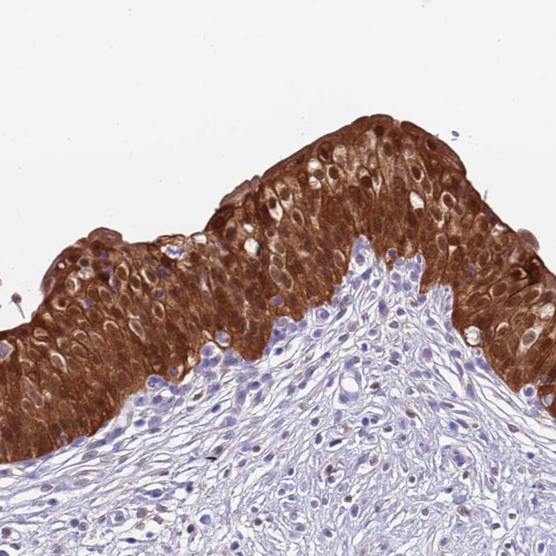 Immunohistochemical staining of human urinary bladder shows strong cytoplasmic, nuclear and membranous positivity in urothelial cells.