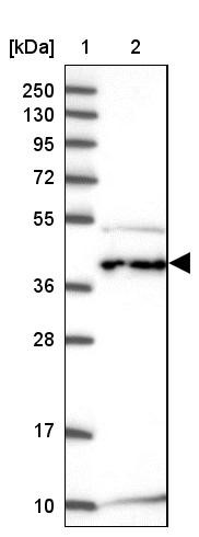 Lane 1: Marker [kDa] 250, 130, 95, 72, 55, 36, 28, 17, 10<br/>Lane 2: Human cell line RT-4