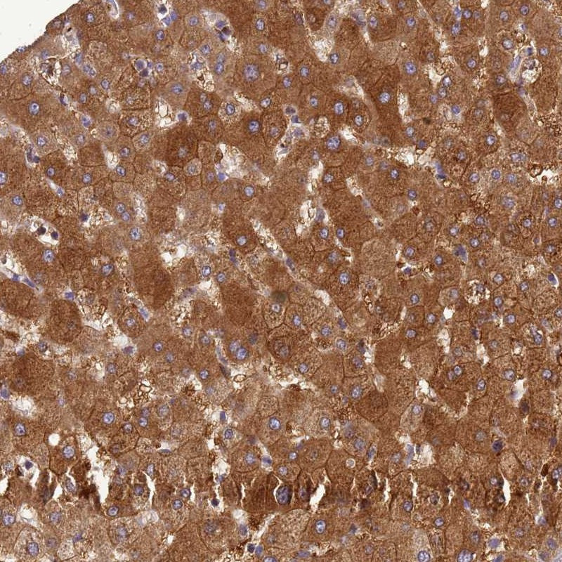 Immunohistochemical staining of human liver shows strong cytoplasmic and membranous positivity in hepatocytes.