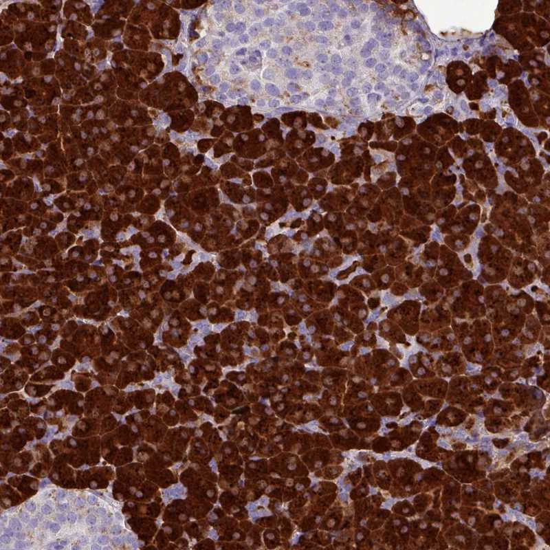 Immunohistochemical staining of human pancreas shows strong cytoplasmic positivity in exocrine glandular cells.