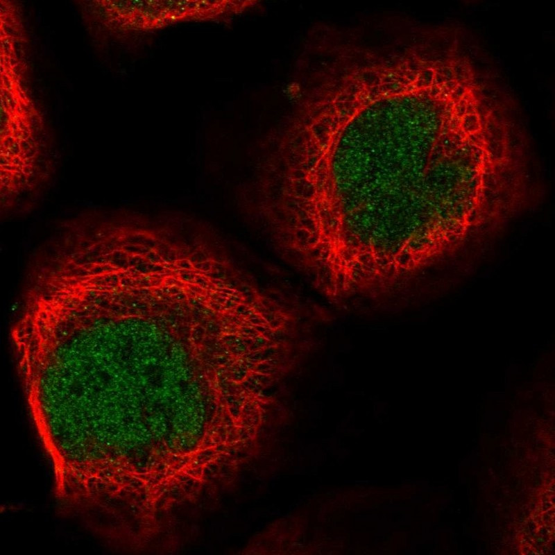 Immunofluorescent staining of human cell line A-431 shows localization to nucleoplasm.