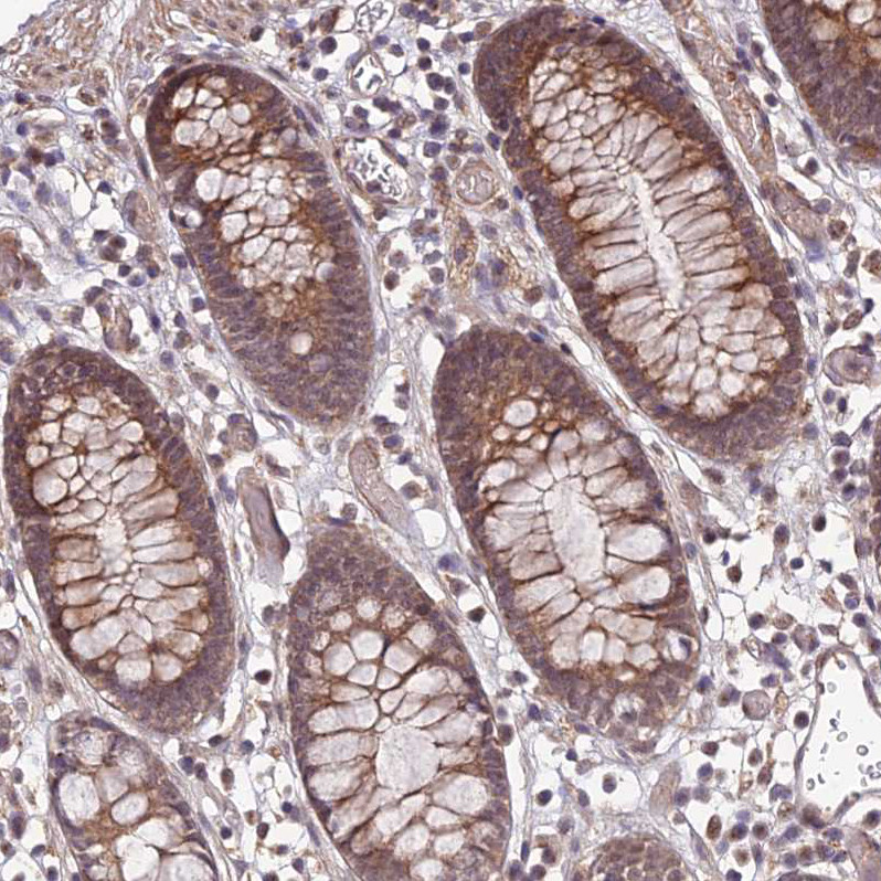 Immunohistochemical staining of human colon shows moderate cytoplasmic positivity in glandular cells.