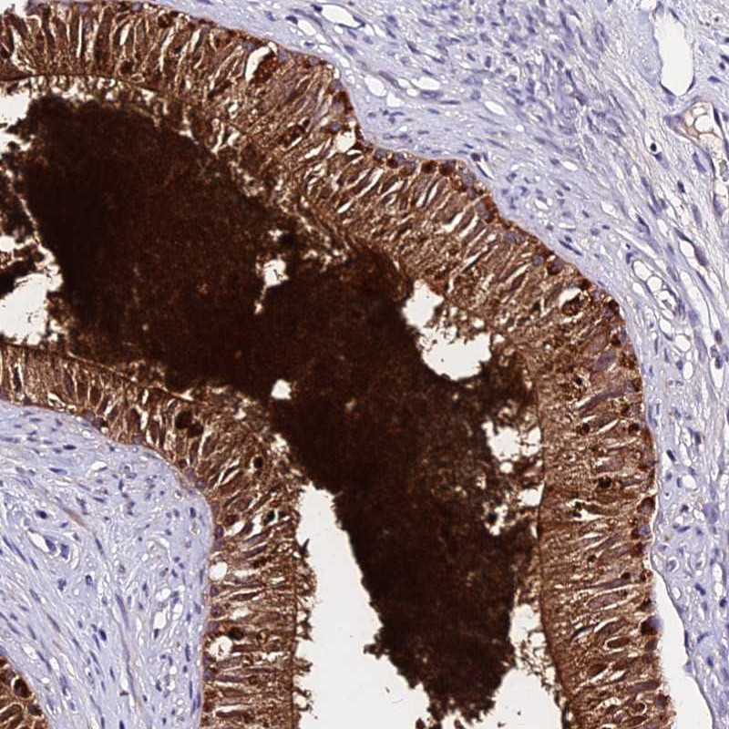 Immunohistochemical staining of human epididymis shows strong positivity.
