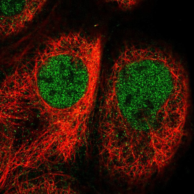 Immunofluorescent staining of human cell line A-431 shows localization to nucleoplasm.
