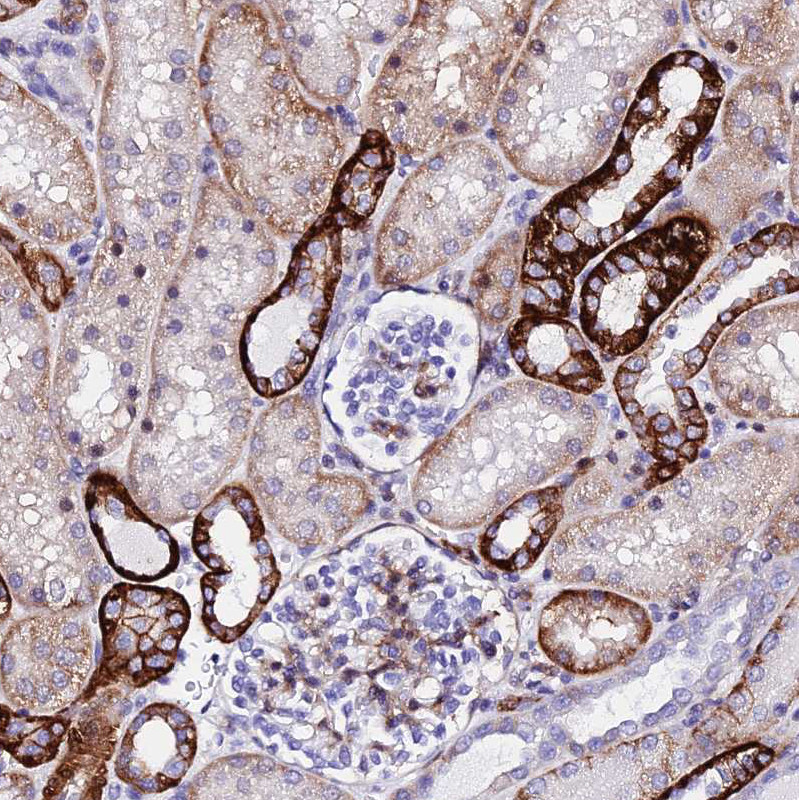 Immunohistochemical staining of human Kidney shows strong cytoplasmic positivity in cells in distal tubules.