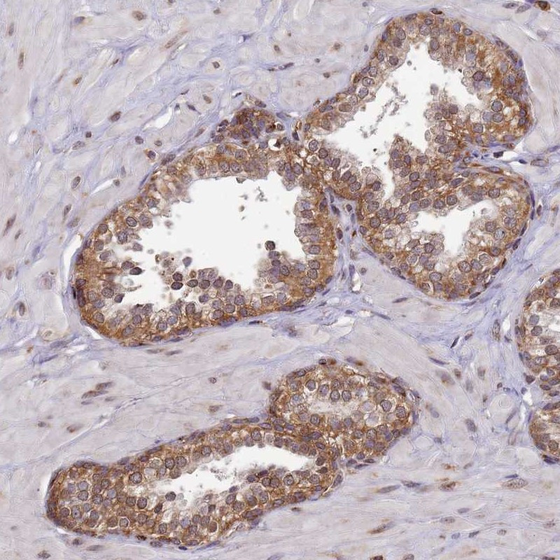 Immunohistochemical staining of human prostate shows moderate cytoplasmic positivity in glandular cells.