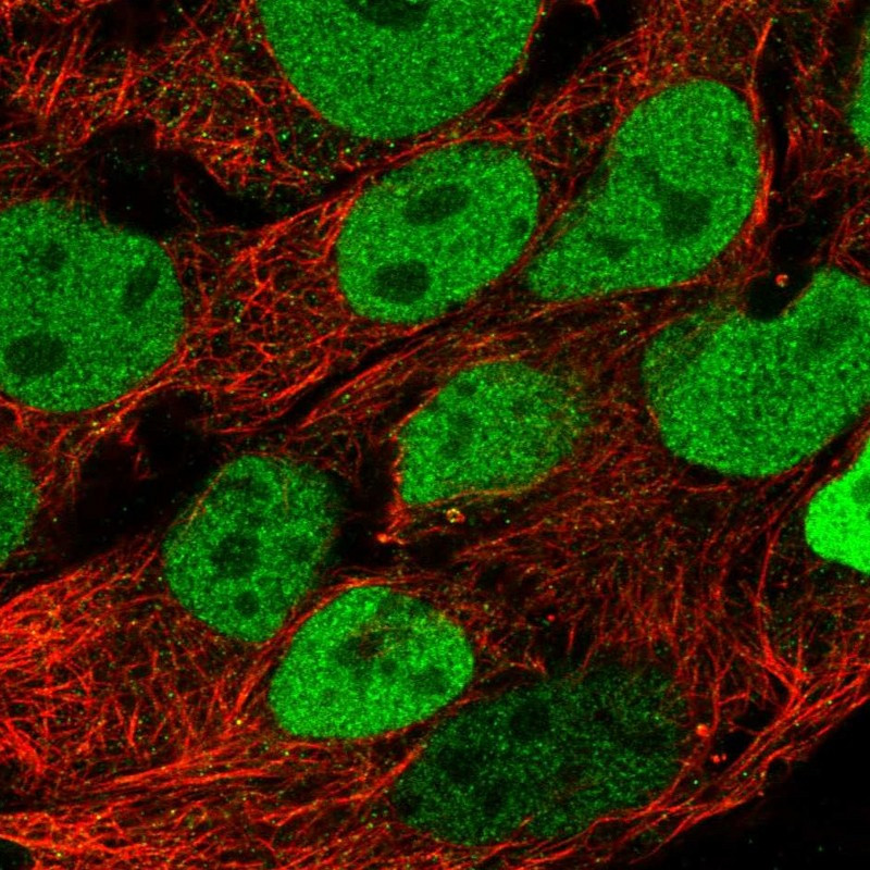 Immunofluorescent staining of human cell line CACO-2 shows localization to nucleoplasm.