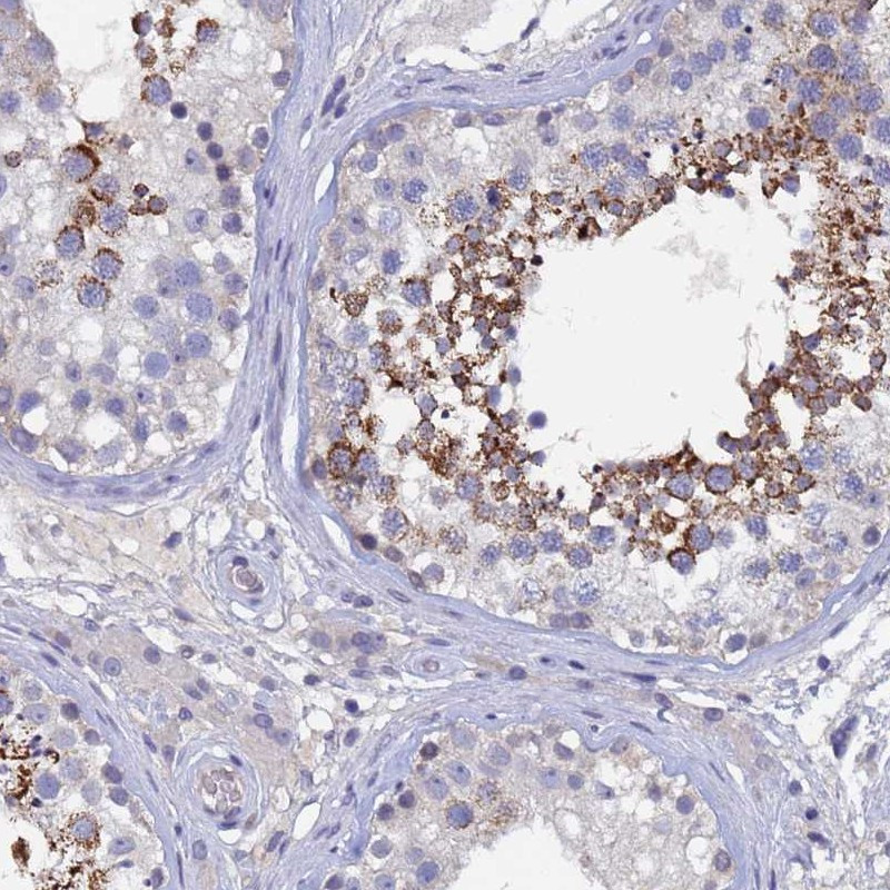 Immunohistochemical staining of human testis shows strong cytoplasmic positivity in subset of cells in seminiferous ducts.