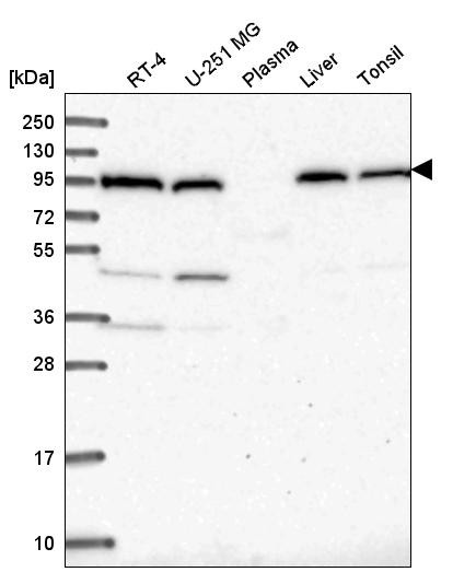 Western blot analysis in human cell line RT-4, human cell line U-251 MG, human plasma, human liver tissue and human tonsil tissue.