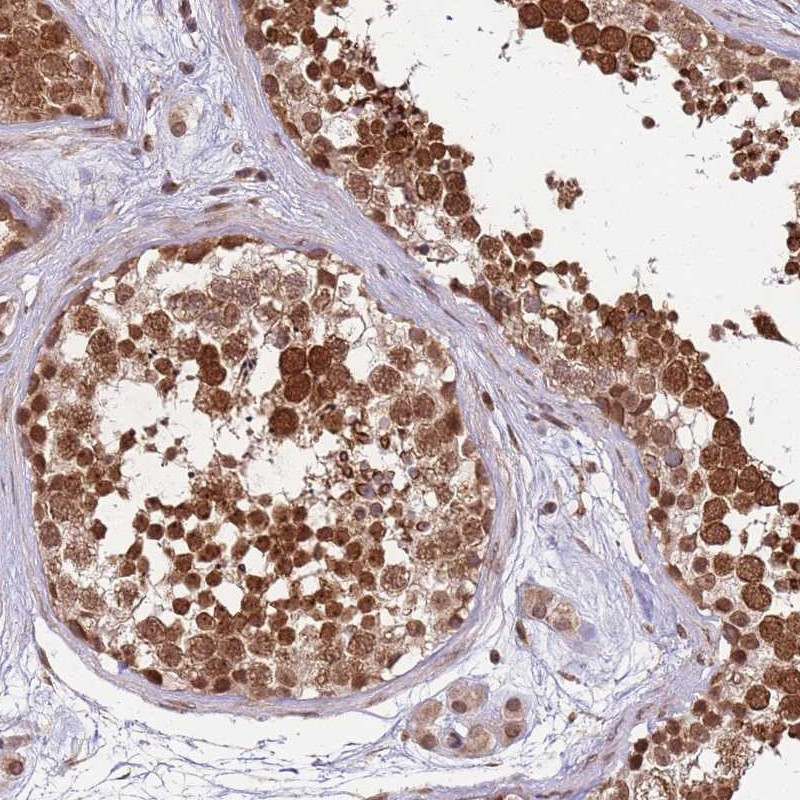 Immunohistochemical staining of human testis shows strong cytoplasmic and nuclear positivity in cells in seminiferus ducts.