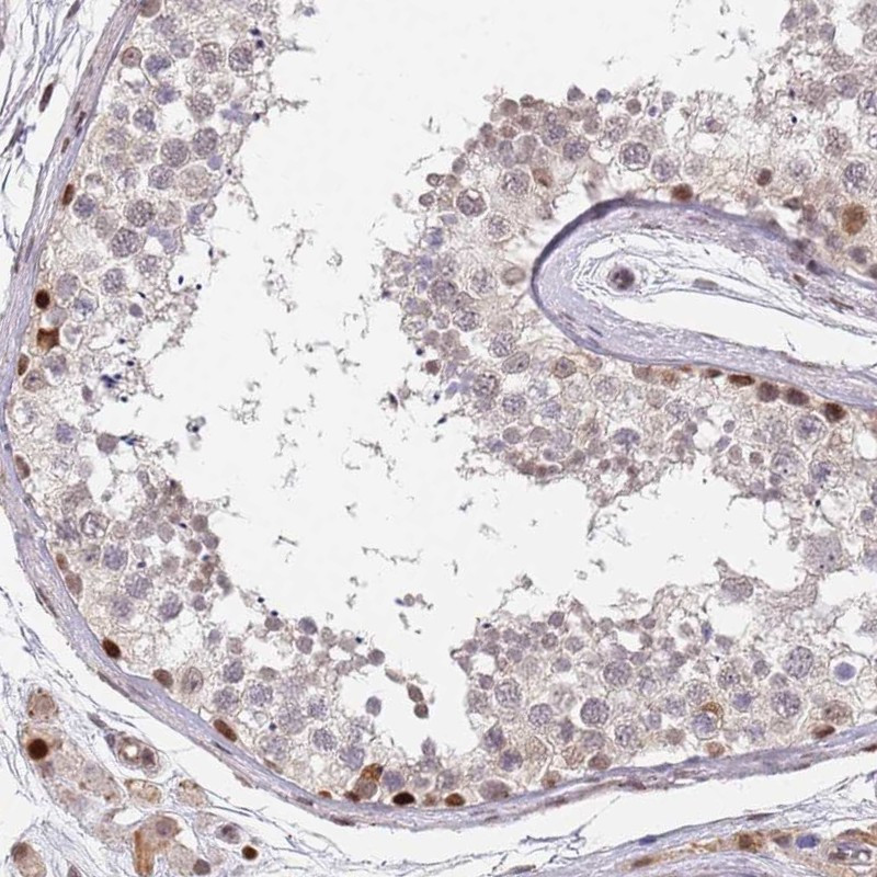 Immunohistochemical staining of human testis shows strong nuclear positivity in Leydig cells and subset of cells in seminiferous ducts.