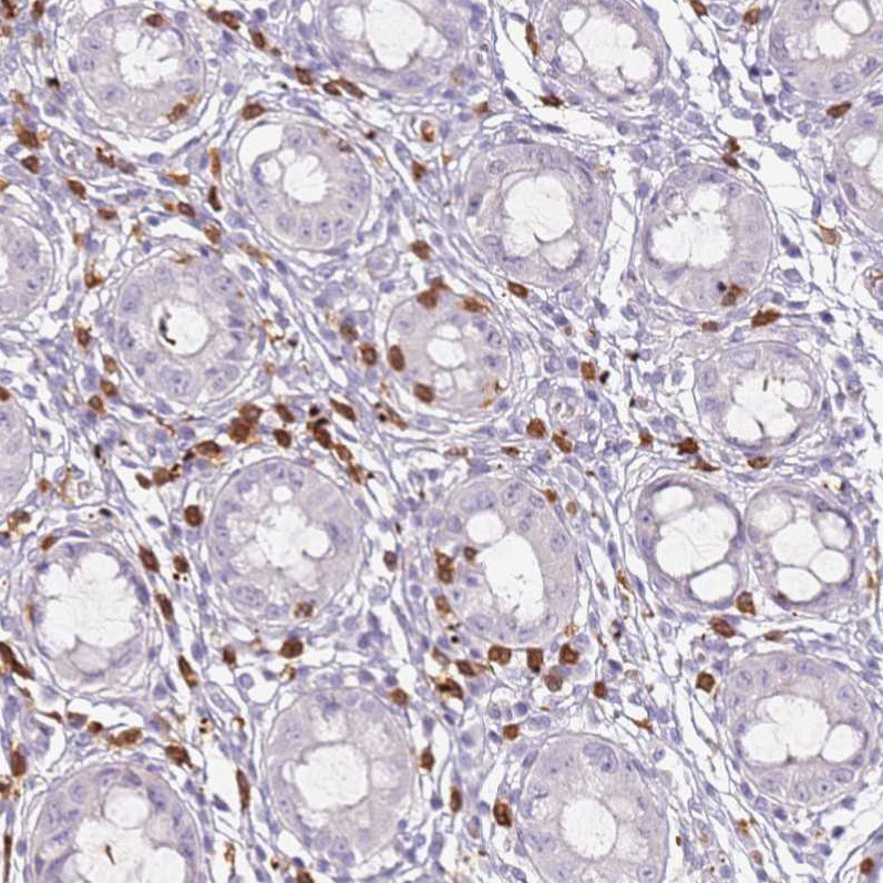 Immunohistochemical staining of human rectum shows strong cytoplasmic positivity in leukocytes.