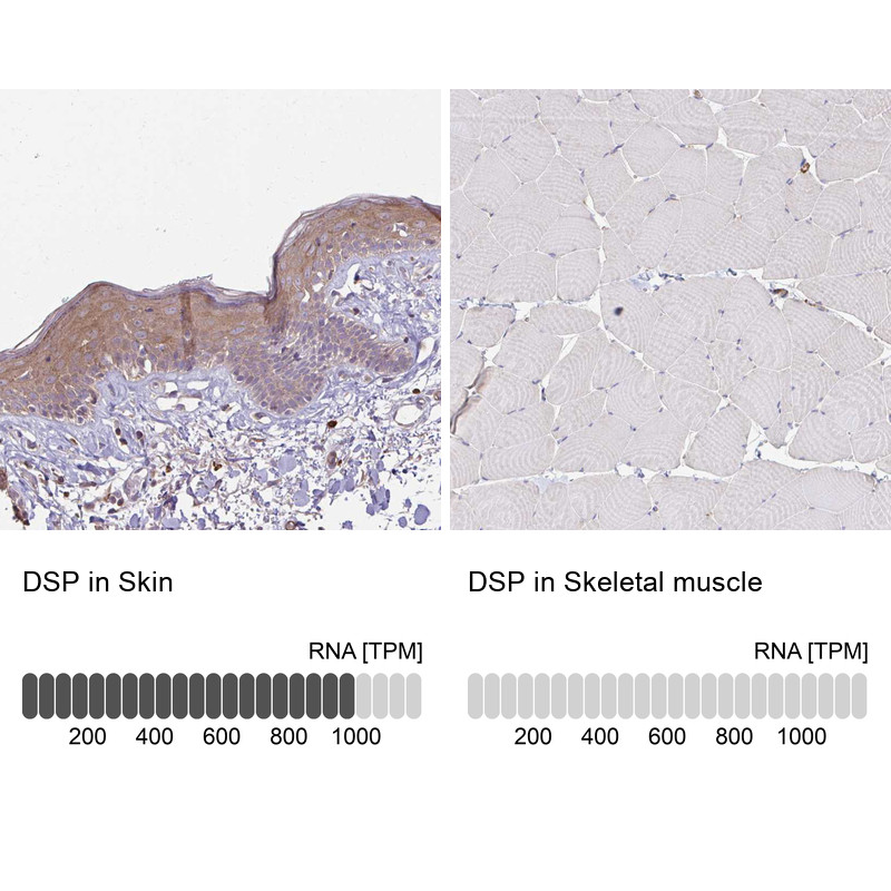 Immunohistochemistry analysis in human skin and skeletal muscle tissues using HPA045840 antibody. Corresponding DSP RNA-seq data are presented for the same tissues.